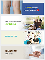 하지 정맥류의 원인부터 치료까지, 한 번에 정리!